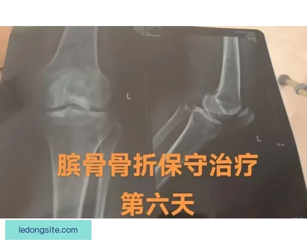 科尔透露穆迪软骨和骨骼无损伤 专家称手术风险较低